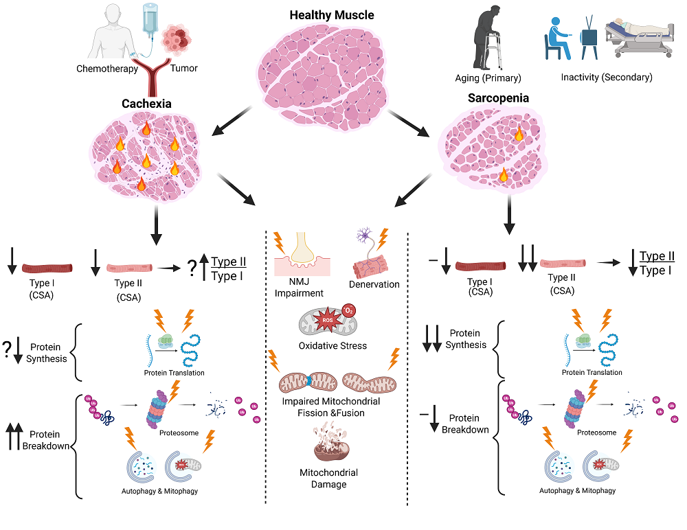 Age-Related Versus Cancer-Related Muscle Loss | Louisiana Cancer